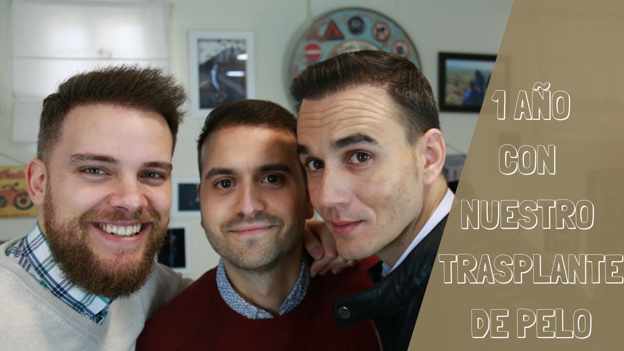 1 año con NUESTRO TRASPLANTE DE PELO: Experiencia y evolución