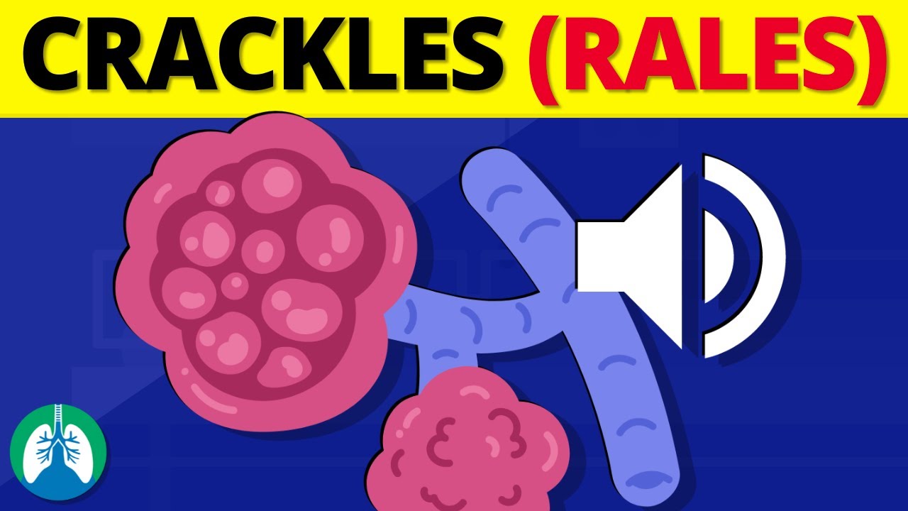 Crackles (Rales) | Medical Definition and Explanation