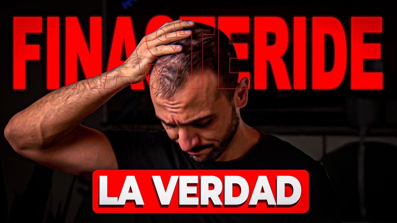 ¿Por Qué el Finasteride Puede Arruinar tu vida?