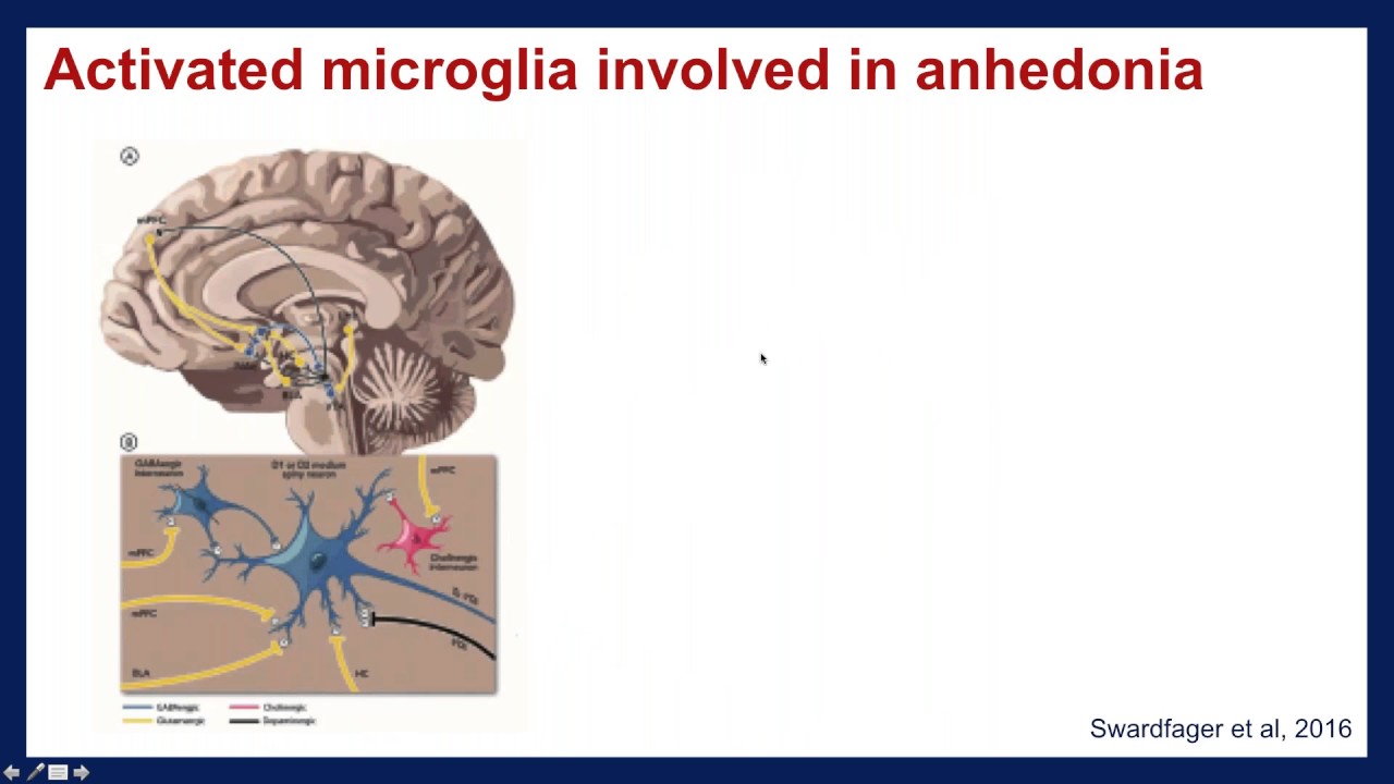 Neuroinflammatory Hypotheses of Depression