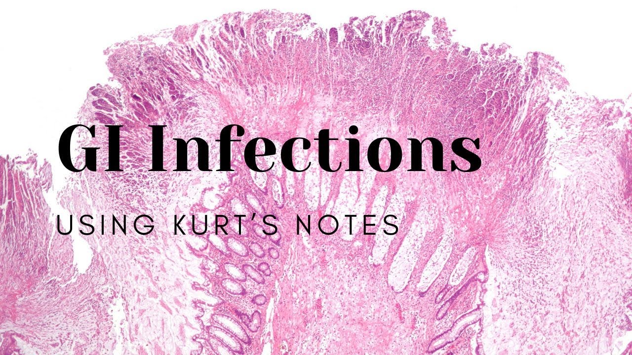 GI Infections: Using Kurt&rsquo;s Notes #pathology #path #gipath #pathagonia