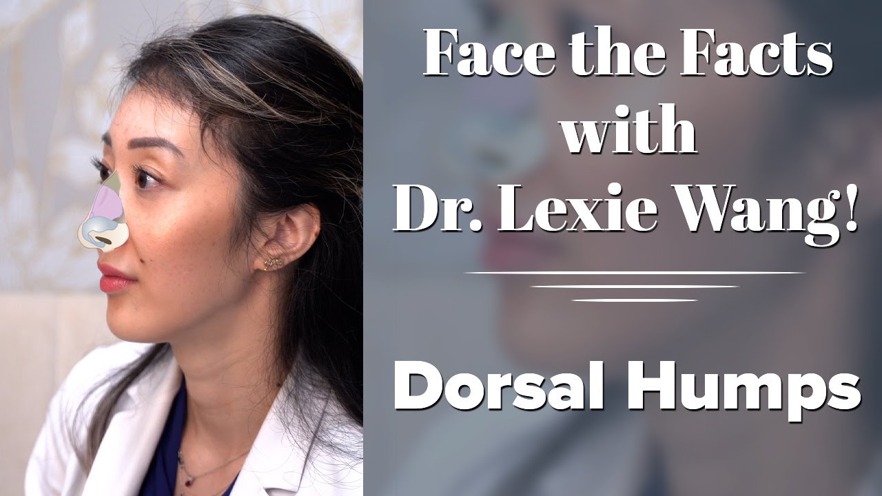 Dorsal Humps - Face the Facts with Dr. Lexie Wang | West End Plastic Surgery