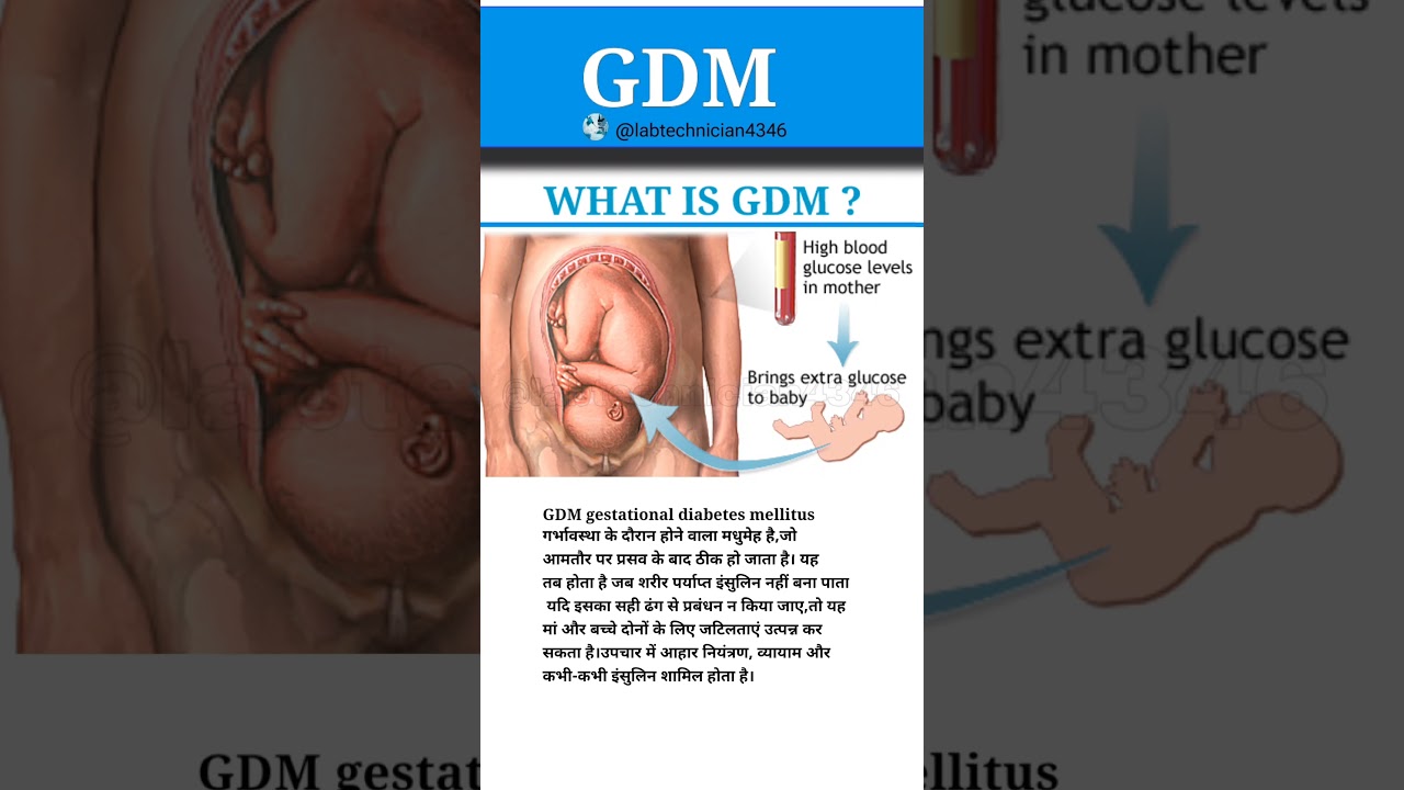 What is GDM|GDM full form|GDM|Gestational Diabetes Mellitus