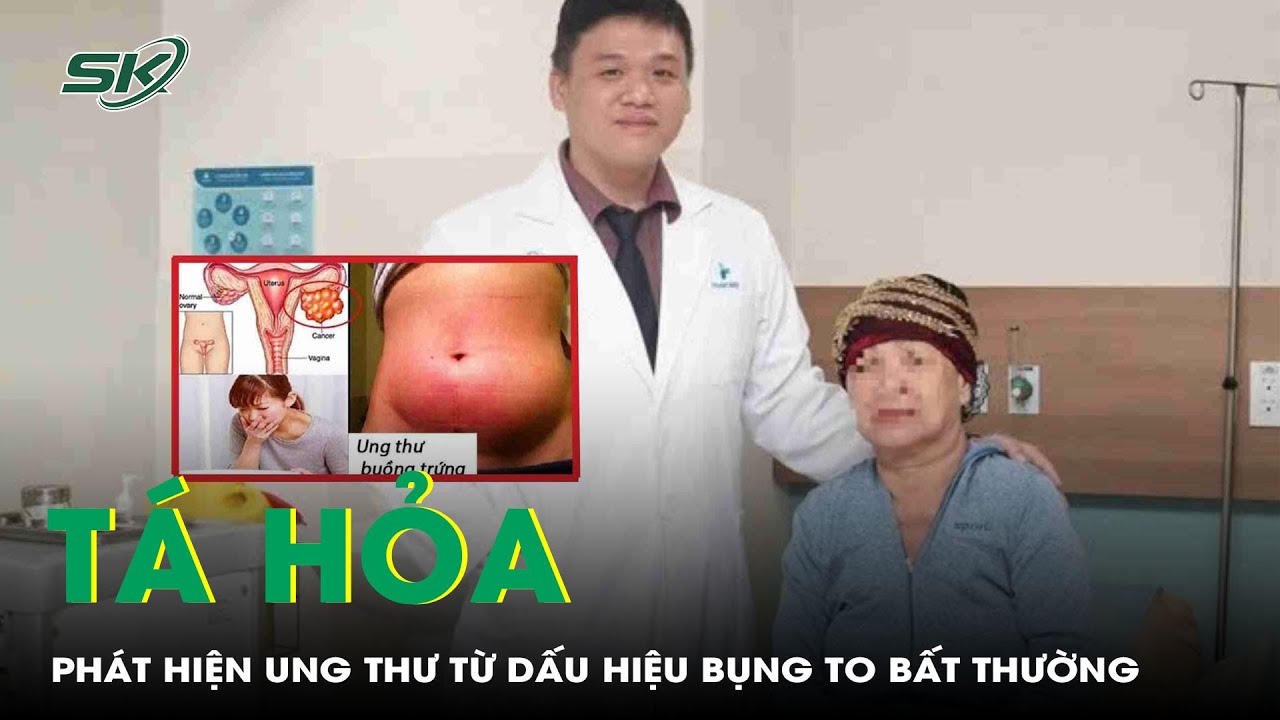 Bụng to bất thường, người phụ nữ tá hoả phát hiện ung thư | SKĐS