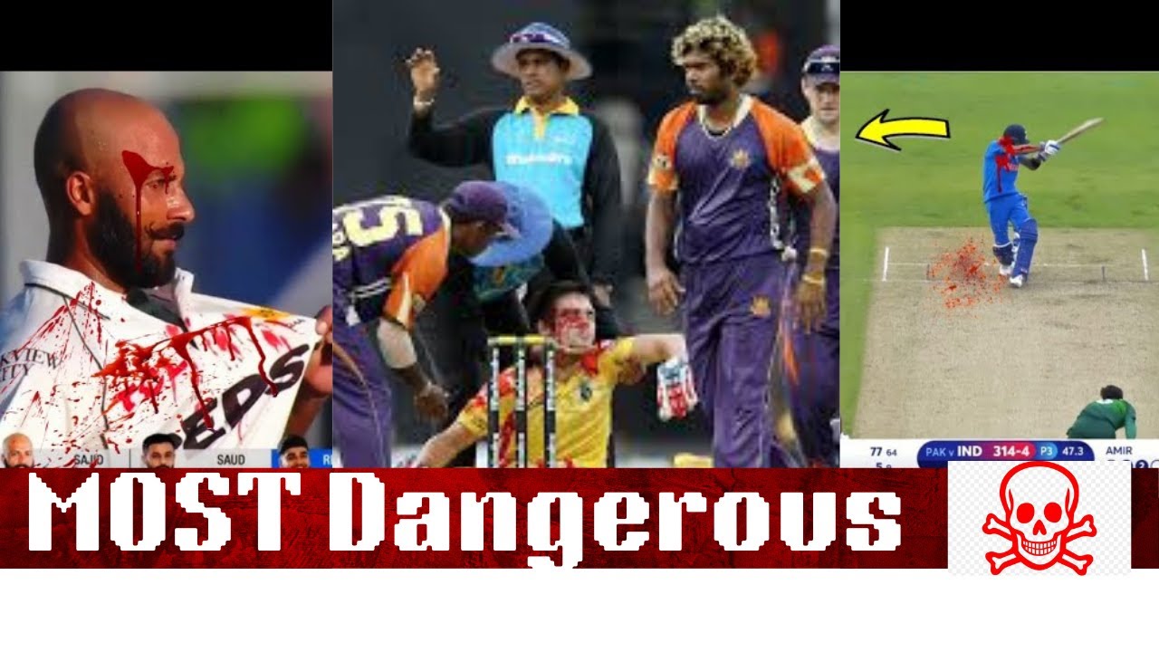 Most dangerous cricket injries #cricketinjury #shoaibakhtar #criceket