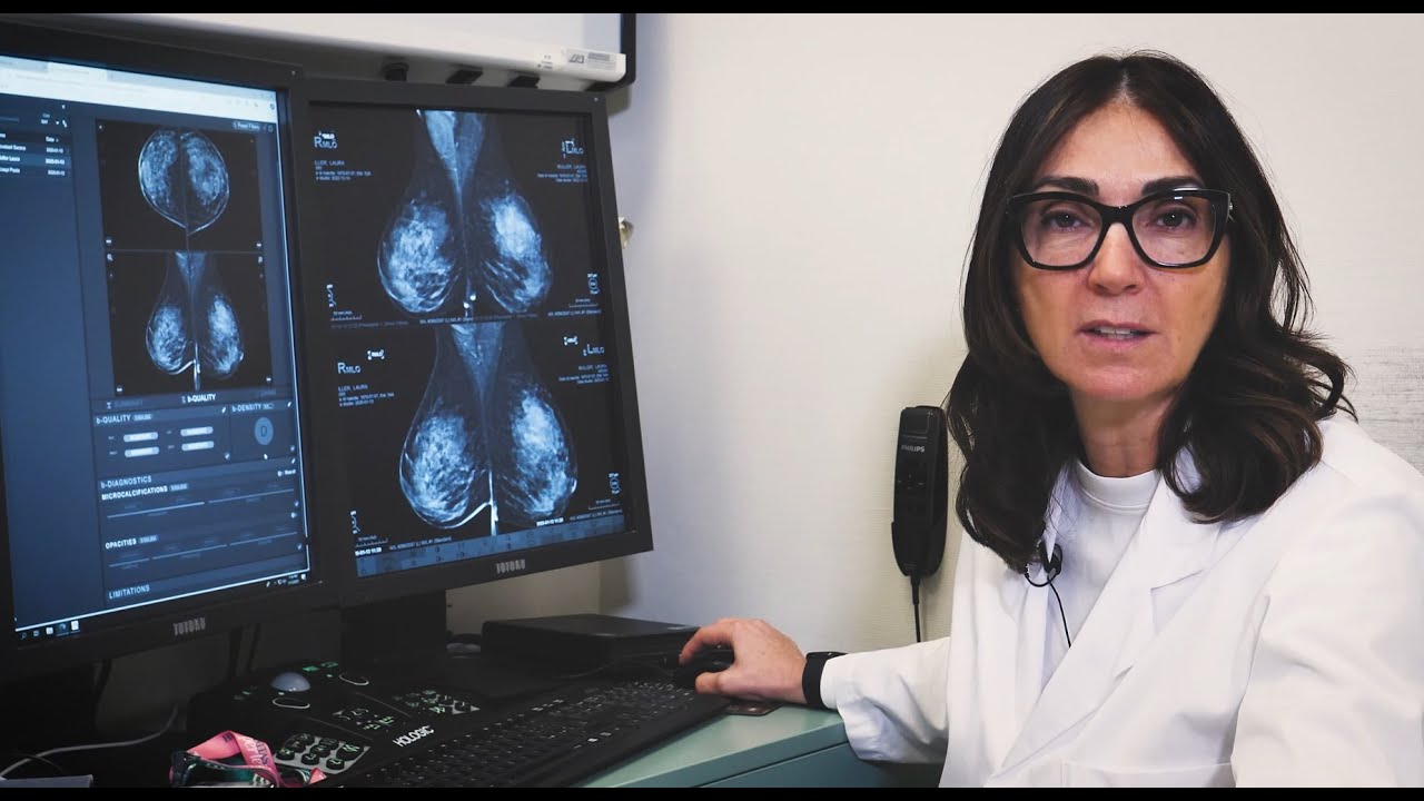 Diagnosi precoce del tumore al seno grazie all’IA
