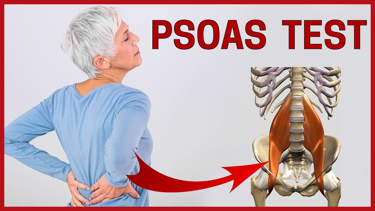 Ist dein Psoas verkürzt oder zu schwach?