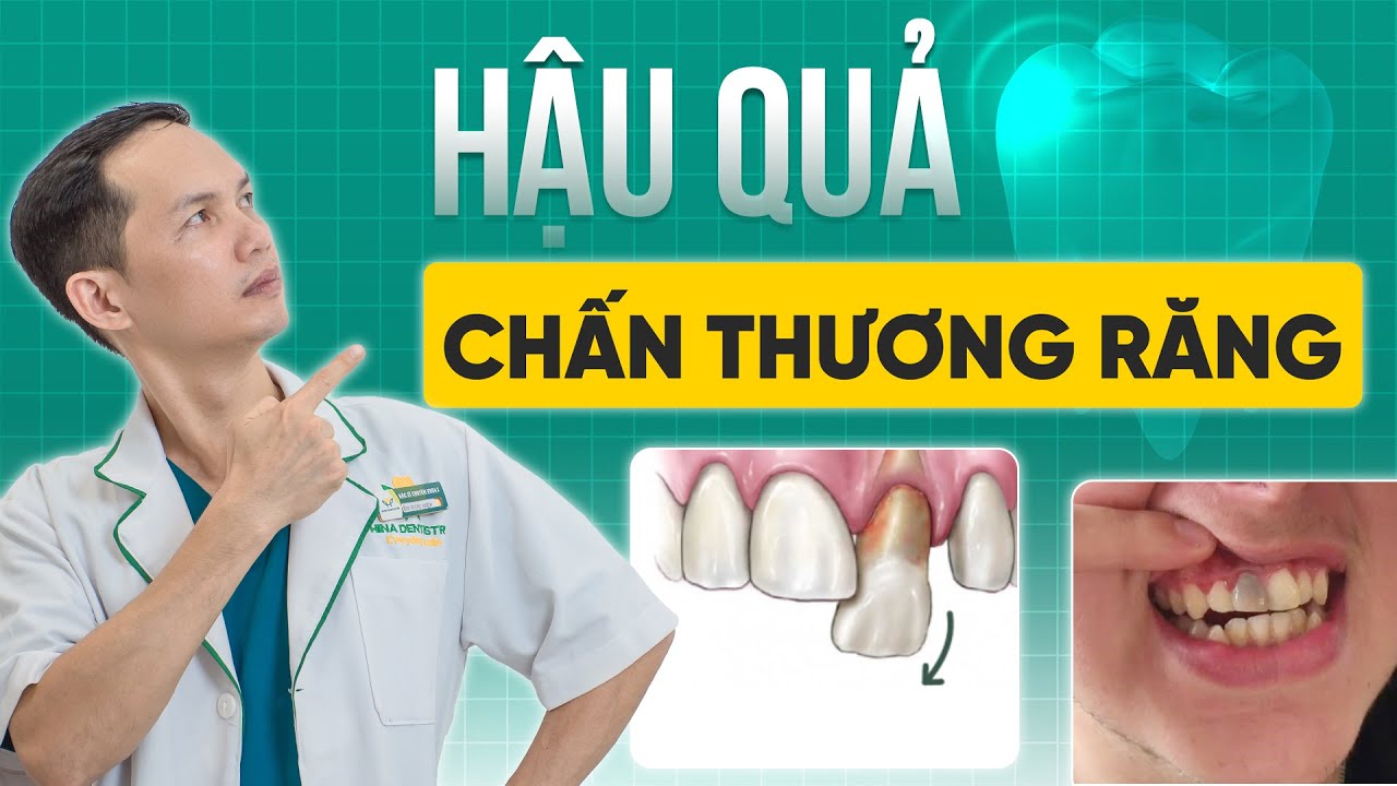 Hậu Quả Nguy Hiểm Của Chấn Thương Răng – Bạn Đừng Xem Thường | Nha Khoa Hina