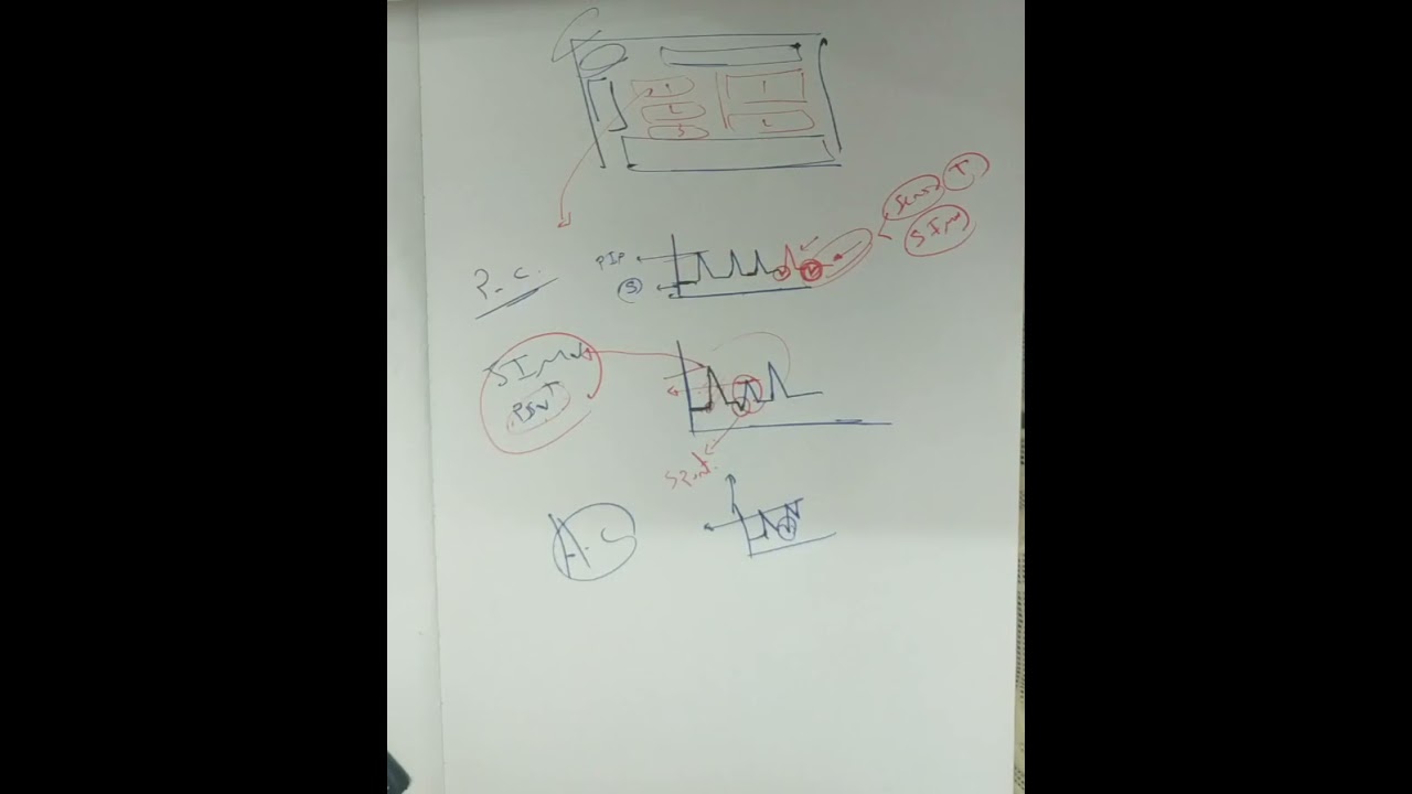 Mechanical ventilation basics 5/ شرح جهاز التنفس الصناعى