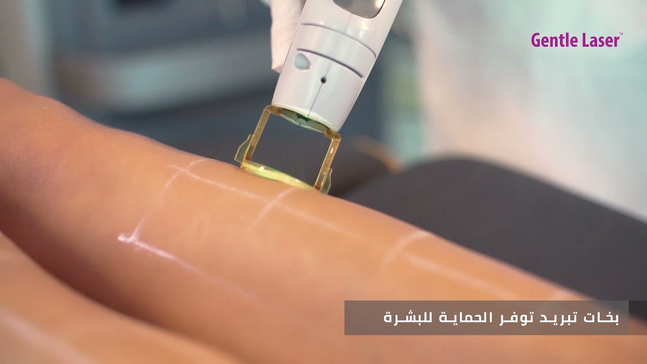 إزالة الشعر بالليزر البارد بجهاز كلانديلا جينتل ماكس برو