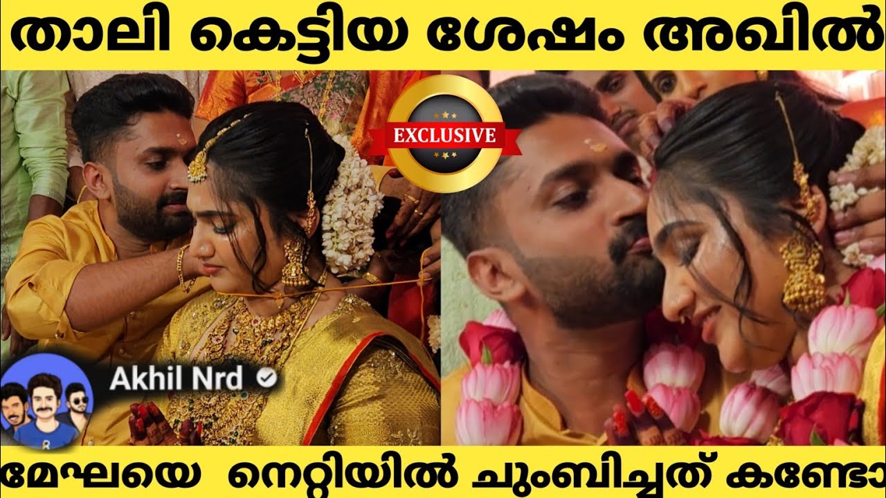 താലികെട്ടി തിരുനെറ്റിയിൽ സിന്ദൂരം തൊട്ട് ചുംബിച്ച് അഖിൽ Nrd| Akhil Nrd