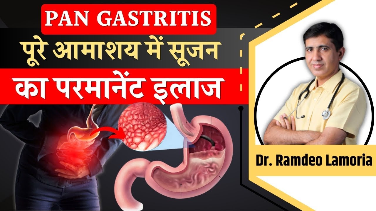 Pangastritis: पैंगैस्टाइटिस की समस्या क्या है | GASTRITIS क्यों होती है ?