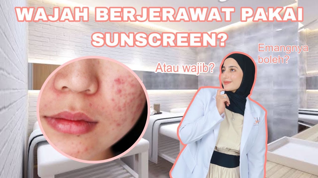 MUKA JERAWATAN WAJIB PAKE SUNSCREEN? (Emang iya muka jerawatan harus tetap pakao sunscreen???)