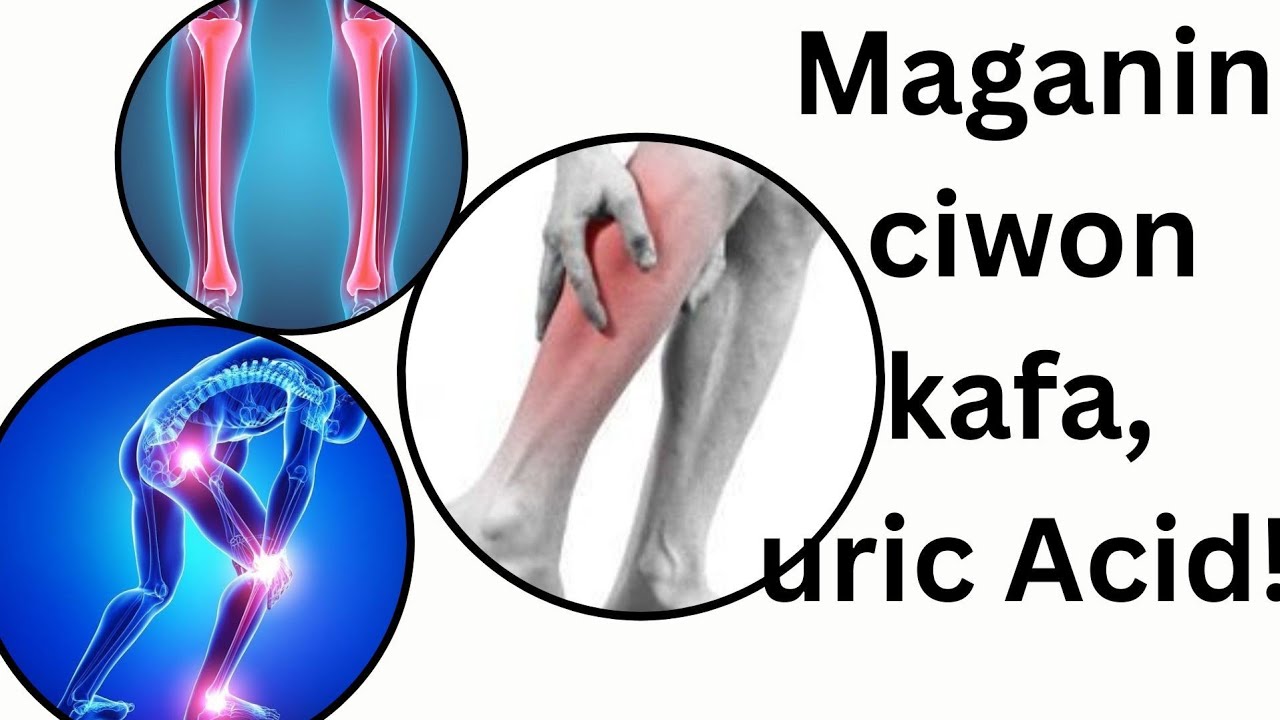 Maganin ciwon kafa, uric Acid! Sheikh Abdulwab goni bauchi #viral #harbal