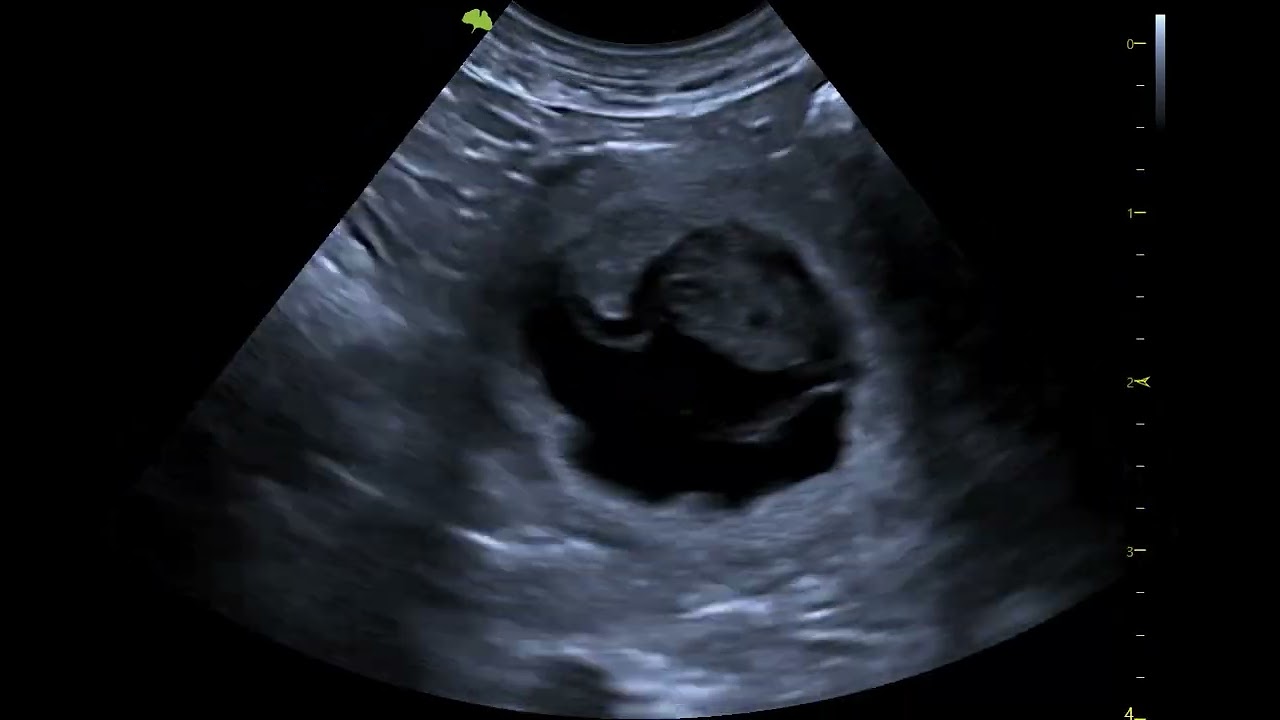 Pregnancy confirmation in a chihuahua