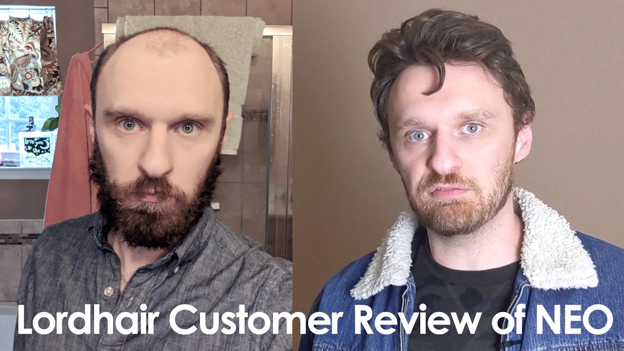 Lordhair Customer Review of Neo Men's Hair System with a Natural Lace Front and Thin Skin Perimeter