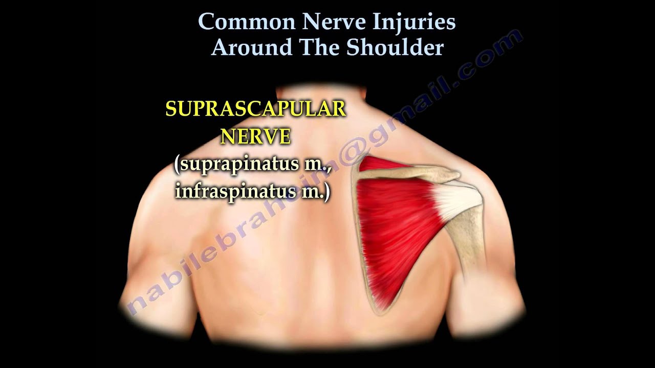 Shoulder Nerve injury ,Injuries  - Everything You Need To Know - Dr. Nabil Ebraheim