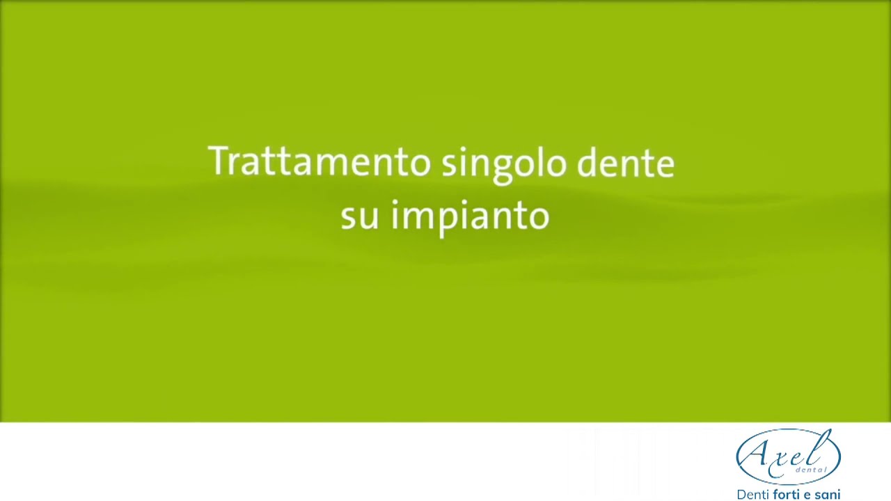 Carico Immediato: Impianto Dente Singolo