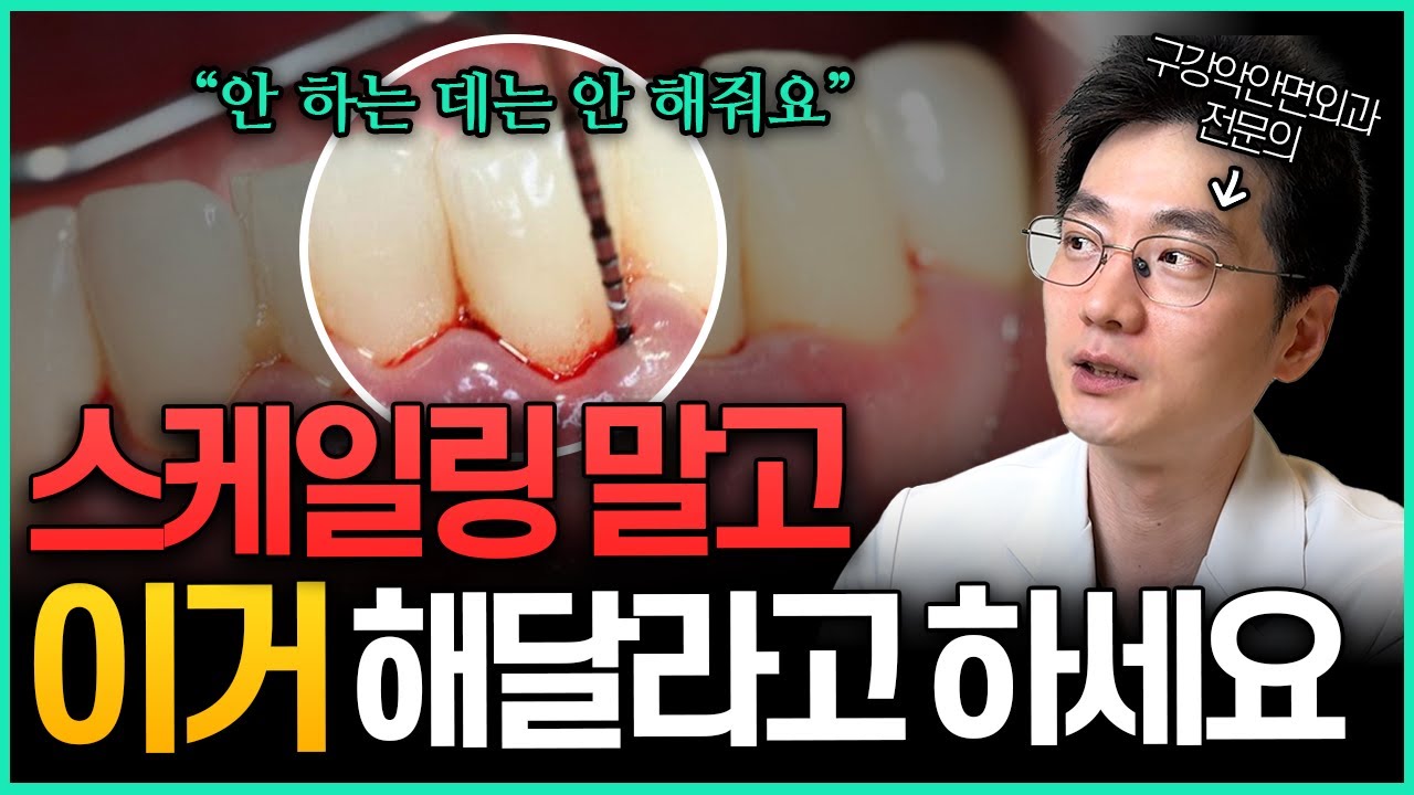 스케일링 말고 &ldquo;이거만&rdquo; 알면 내 치아 평생 지킬 수 있습니다!