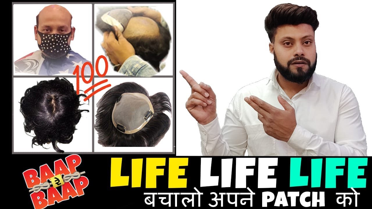 What is the life of different patches | Hair Wig Price, Quality & Life Explained in Hindi
