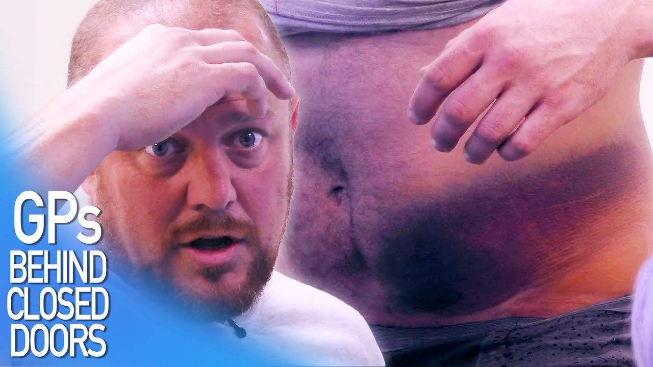 Motorbike Accident Injury | GPs: Behind Closed Doors
