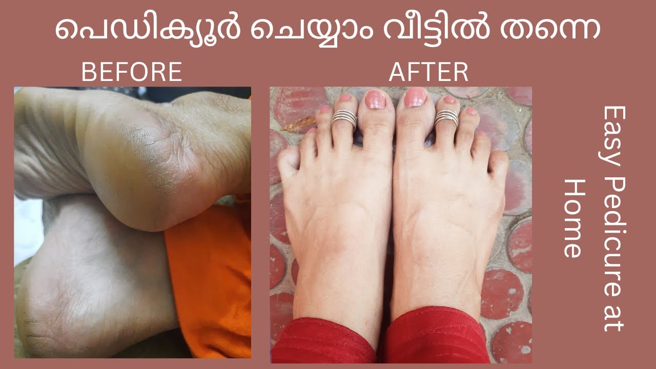പെഡിക്യൂർ ചെയ്യാം വീട്ടിൽ തന്നെ | Easy Pedicure @ Home|10 Min results| Malayalam|No Chemicals used
