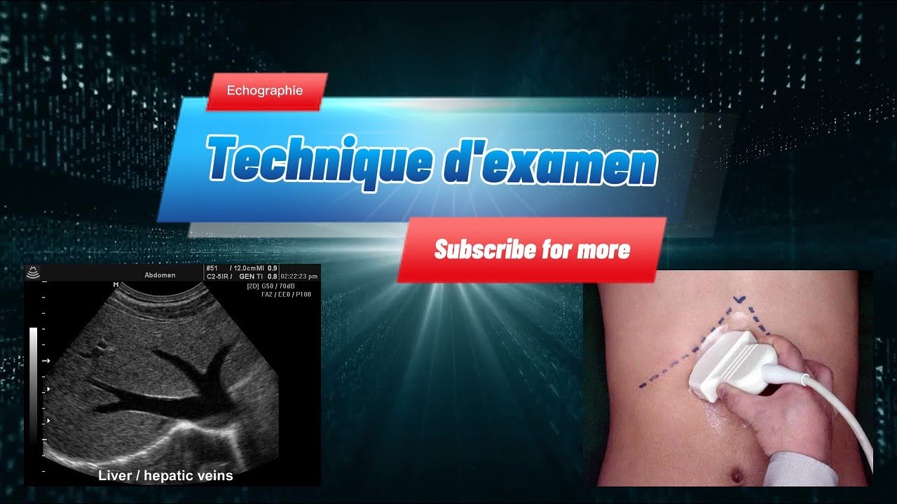Technique d'examen Echographie, Learning Ultrasound, Medical Learning NS,