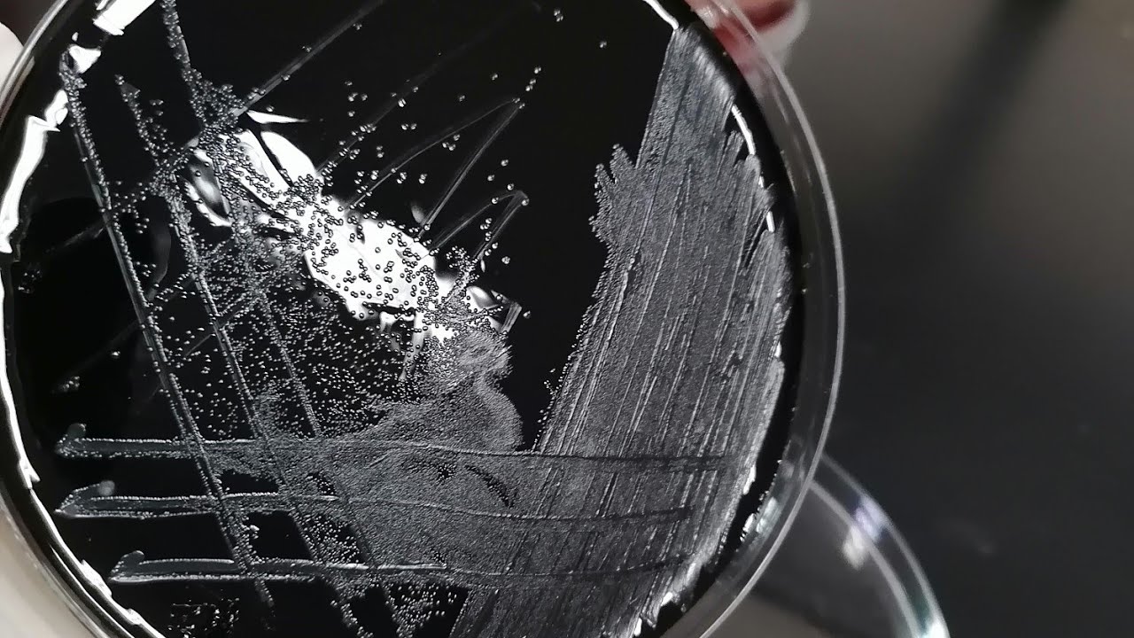 شرح bile esculin test