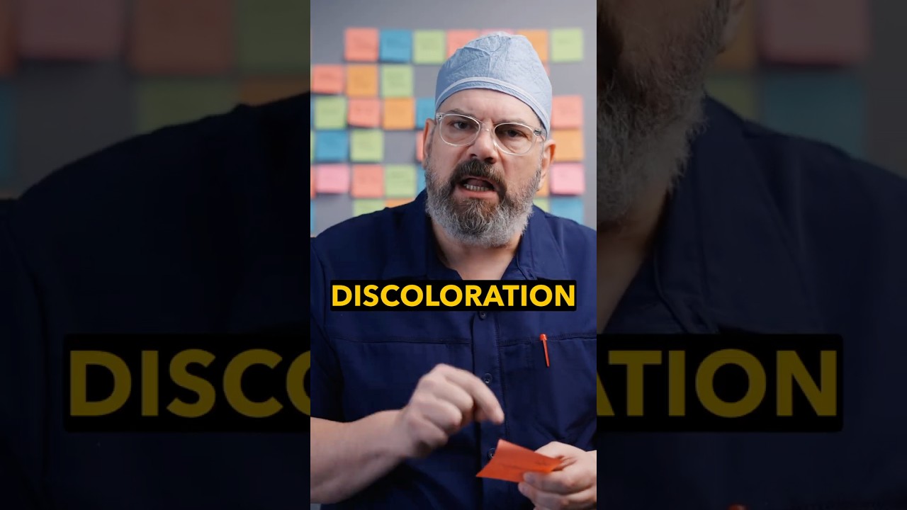 Day 96: How do I deal with skin discoloration? #99problems #skindiscoloration