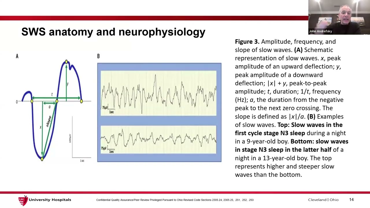 2026.03.10 - CWRU SMGR: Dr. John Andrefsky - Slow wave sleep