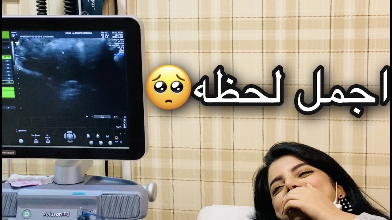اول سونار ، سمعنا دگات گلب البيبي 🥺 مؤثر