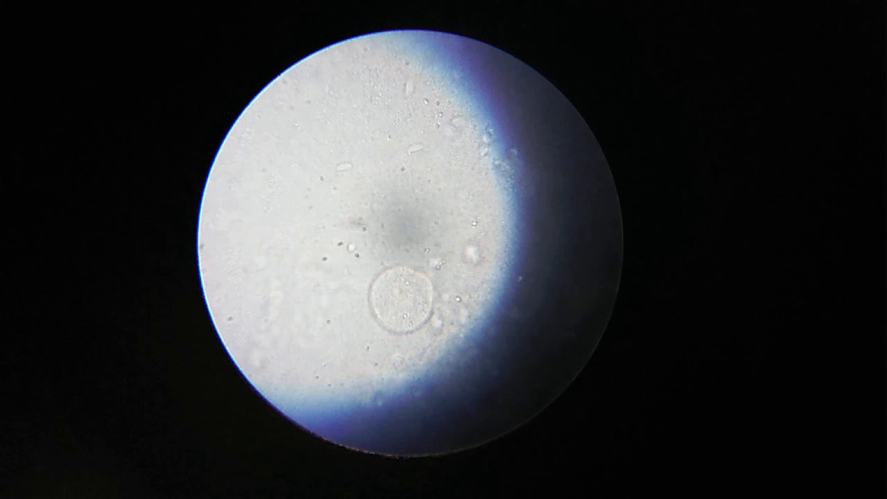 Paramoecium under microscope