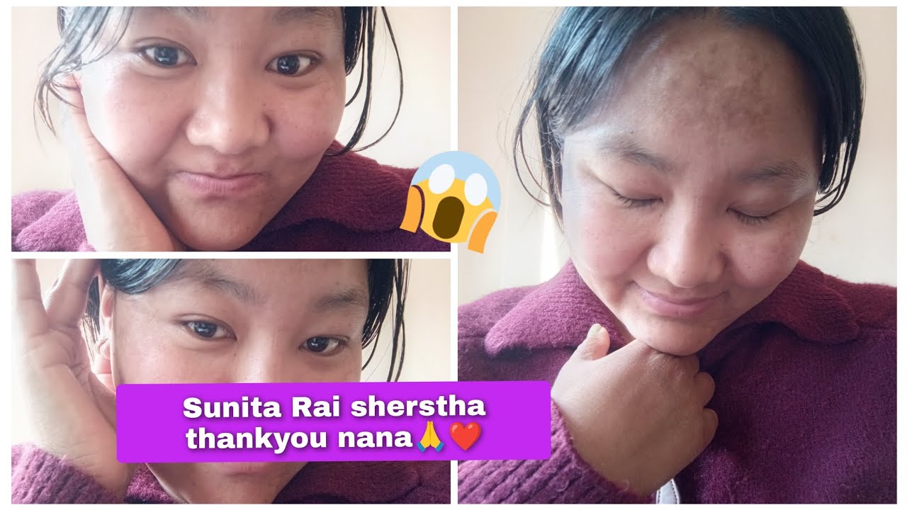 सुनिता राई श्रेष्ठ 😱 म एक्लै खुशी हुदै अनि तपाईंहरुलाई मेरो खुशी बाँड्दै💌