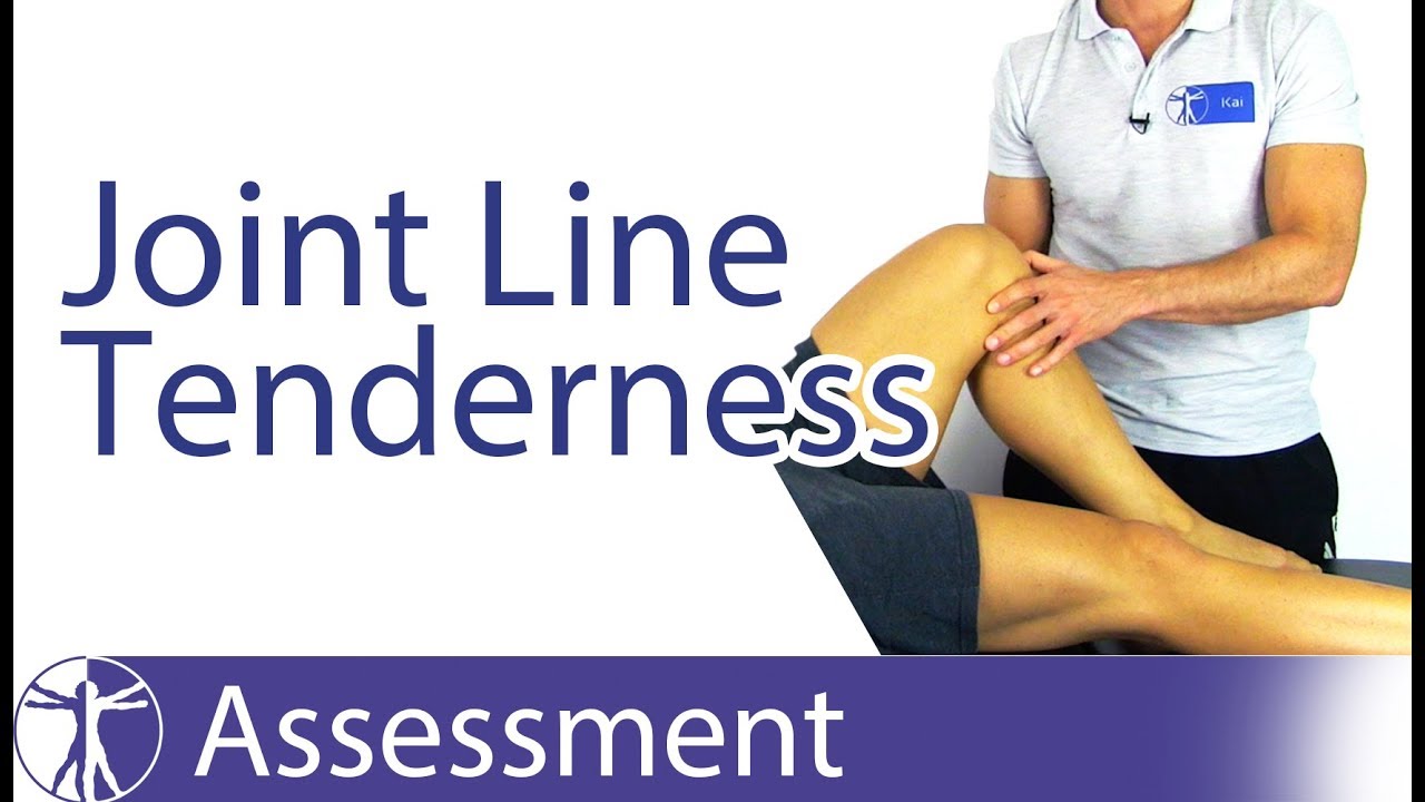 Joint Line Tenderness Palpation | Meniscus Tear