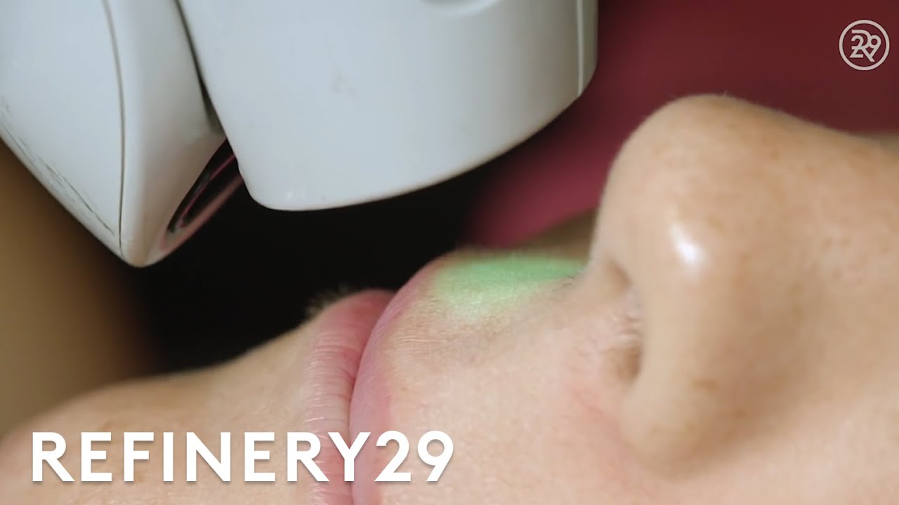 I Got Laser Hair Removal For The First Time | Macro Beauty | Refinery29