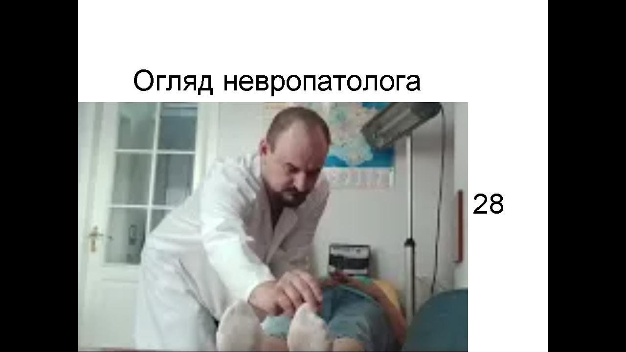 Неврологічний огляд від доктора Голода 28