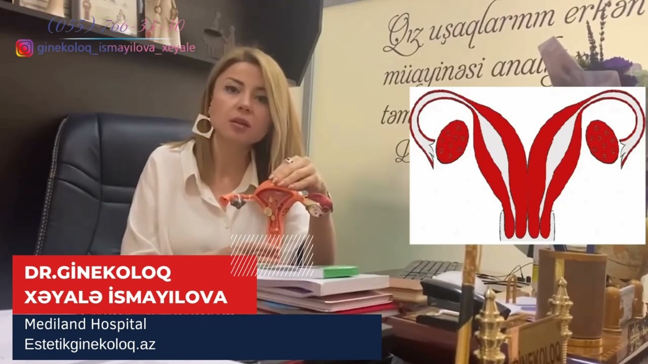 Uşaqlığın inkişafdan qalması. Uşaqlıq anolmaliyaları - Ginekoloq Xəyalə İsmayılova