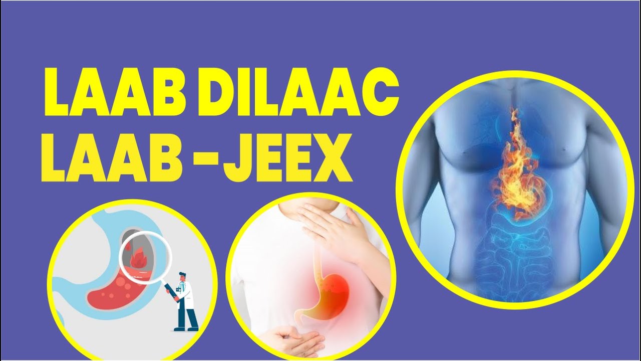 Laab-Dillaac ama Laab-jeex Ka Rayso | Heart Burn Explained