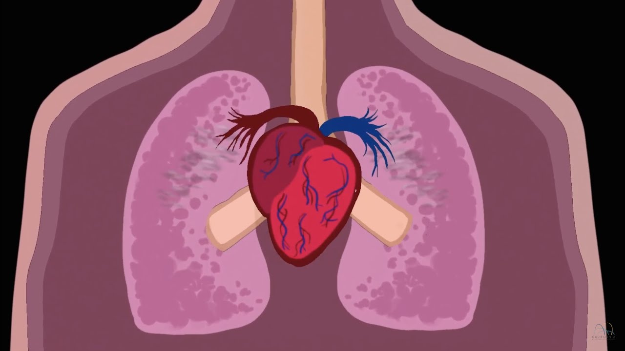 Efectos sobre la salud de las contaminaciones atmosf&eacute;ricas