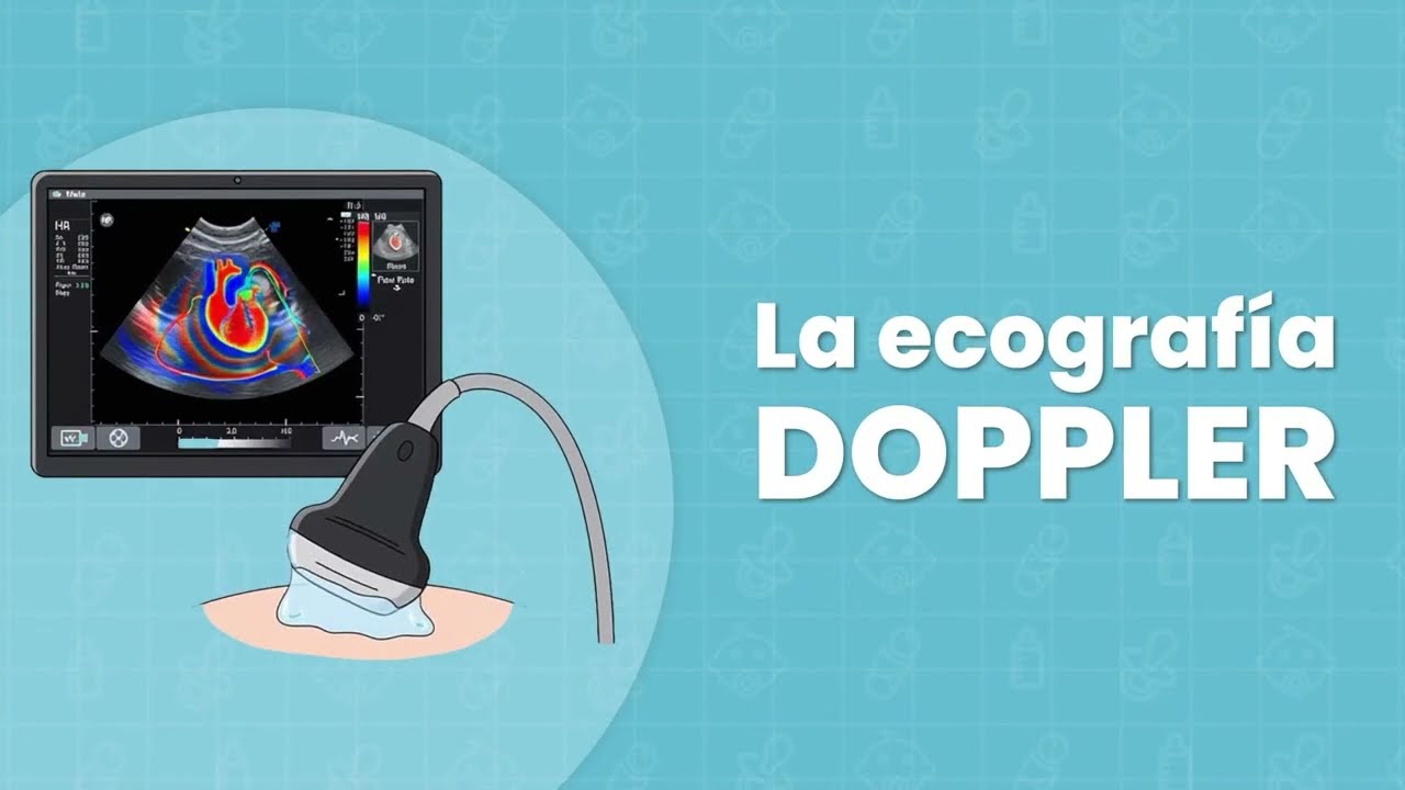 ¿Qué es la Ecografía Doppler?