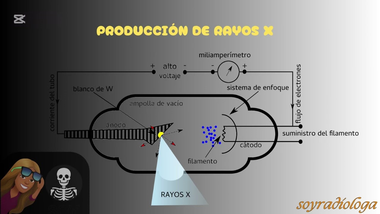 ASÍ FUNCIONAN LOS RAYOS X (te lo explico en menos de 2 minutos)