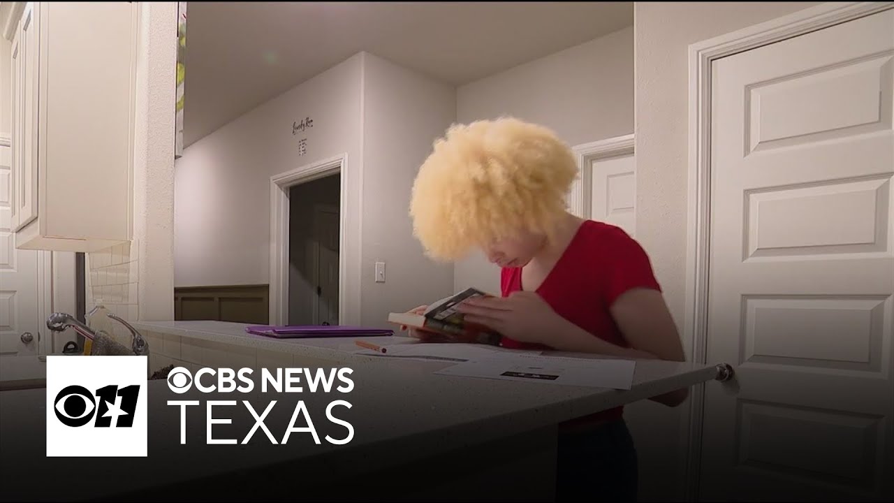Royse City ISD mother of 5 speaks out after daughter with albinism bullied at middle school