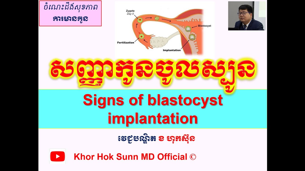 Signs of blastocyst implantation/សញ្ញាកូនចូលស្បូន l Khor Hok Sunn MD Official