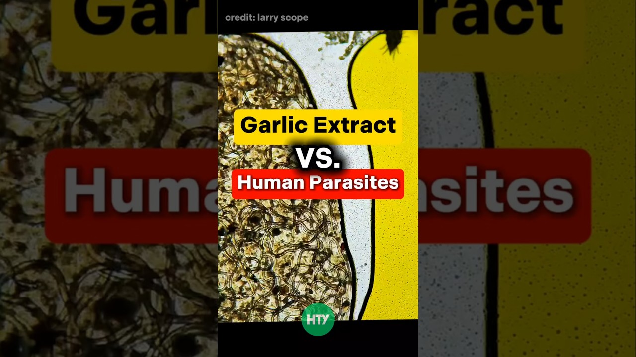 Garlic Extract vs. Parasitic Worms &ndash; You Won&rsquo;t Believe This! 🧄🧬