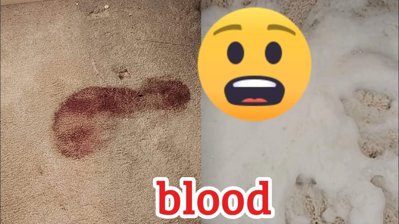 Blood cleanup