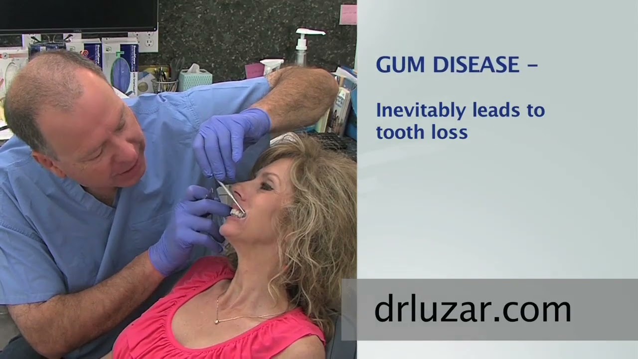 Dental Exams