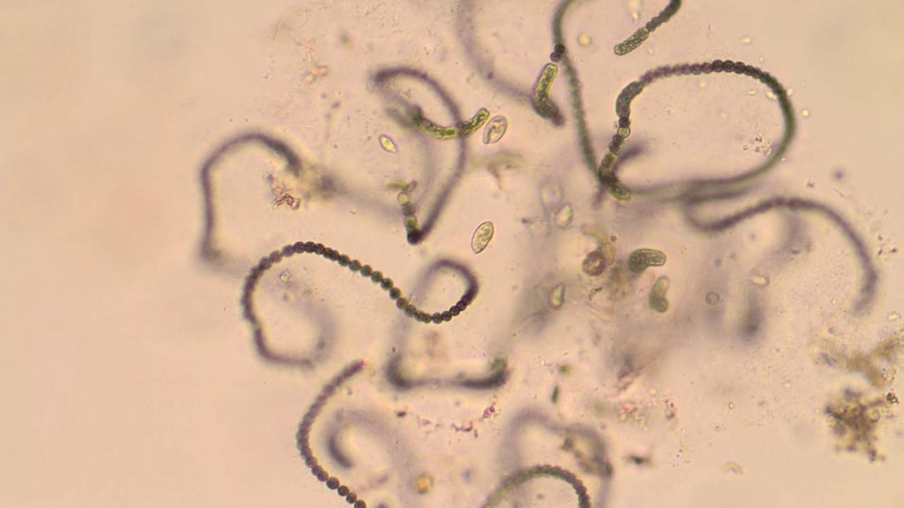 Protozoa feeding on a decaying colony of Anabaena cyanobacteria