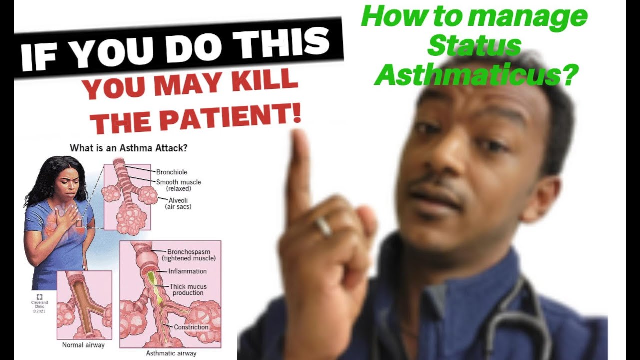 Managing the mechanically ventilated status asthmaticus patient