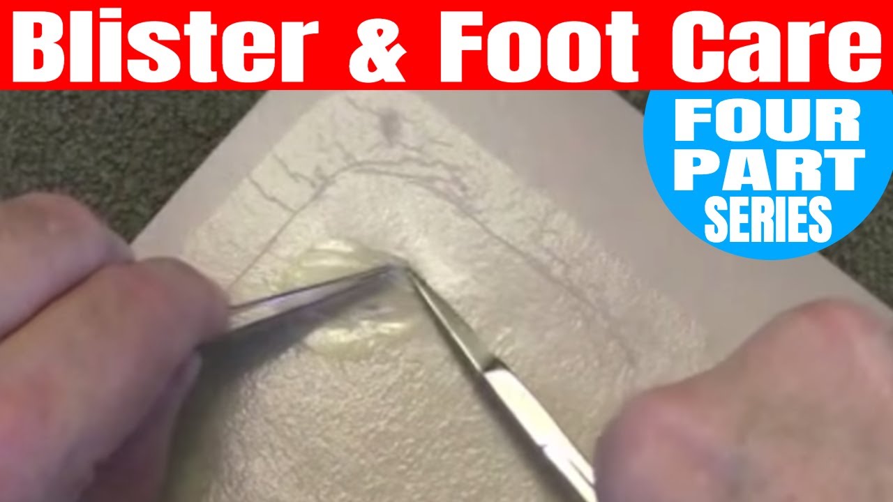 Pocket Blister Care Kit - PART IV (Blister Simulator)
