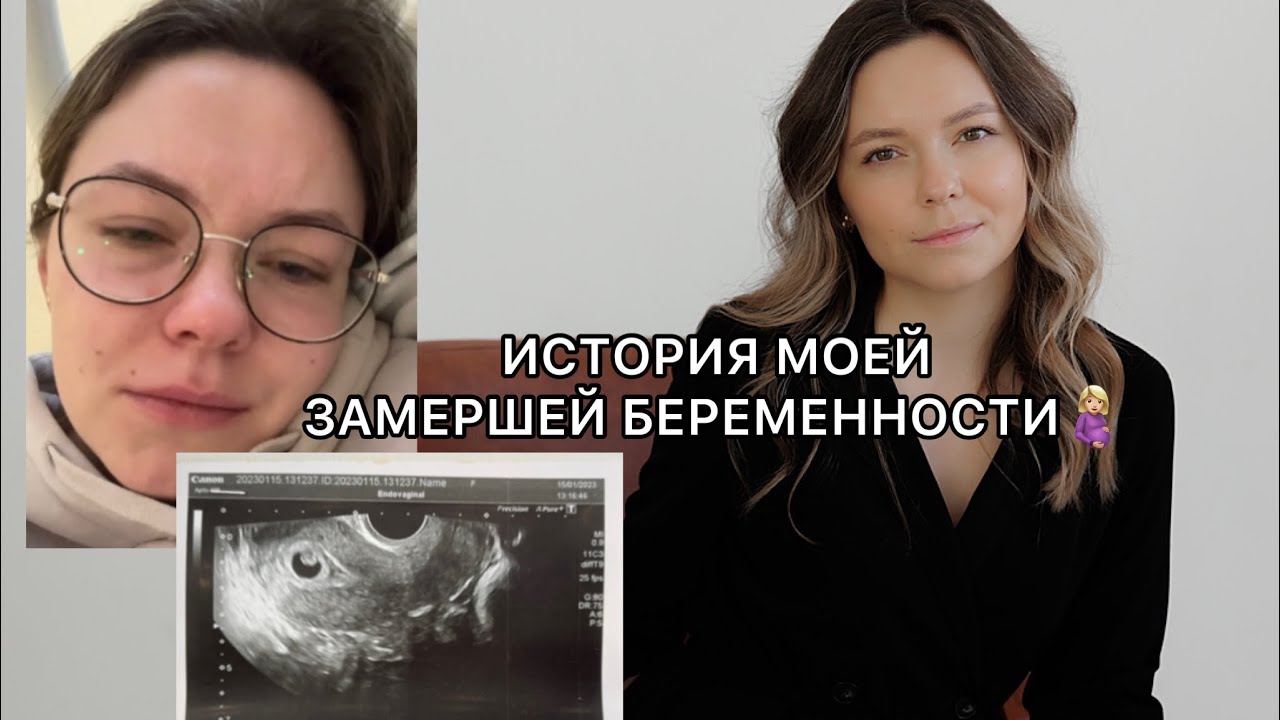 МОЯ ЗАМЕРШАЯ БЕРЕМЕННОСТЬ на 8 неделе